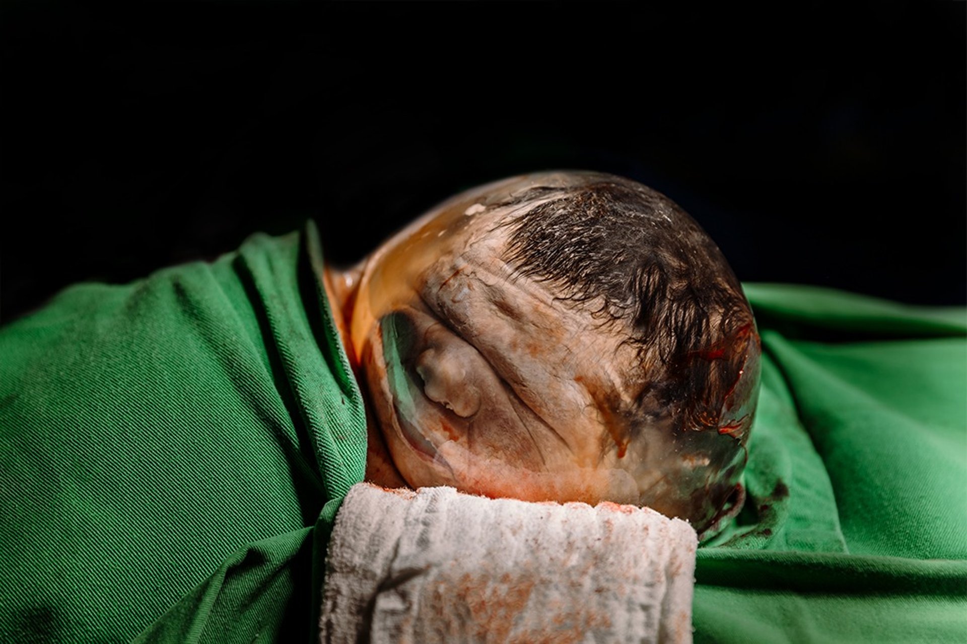 black and white bed linen