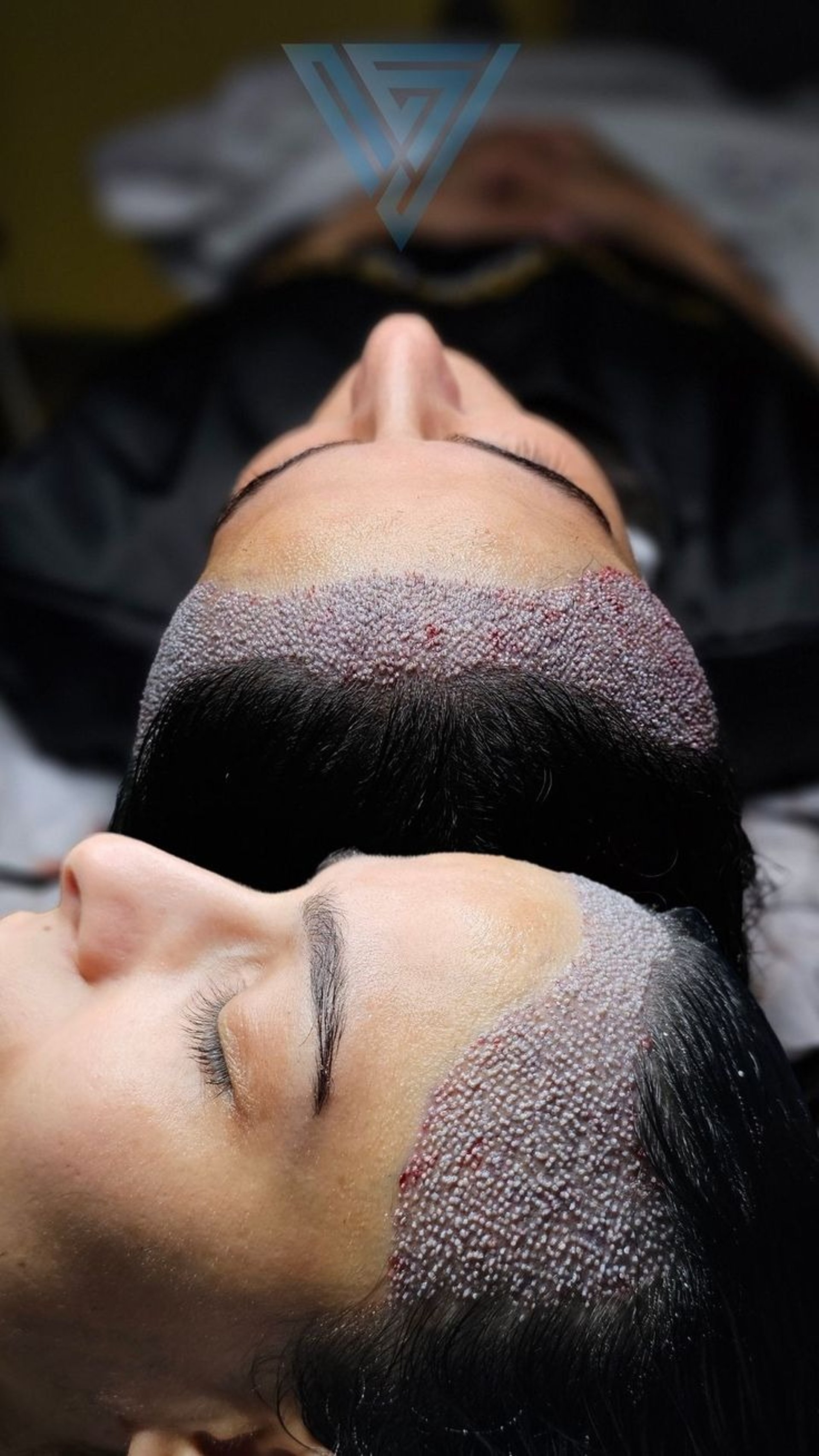 black and white bed linen