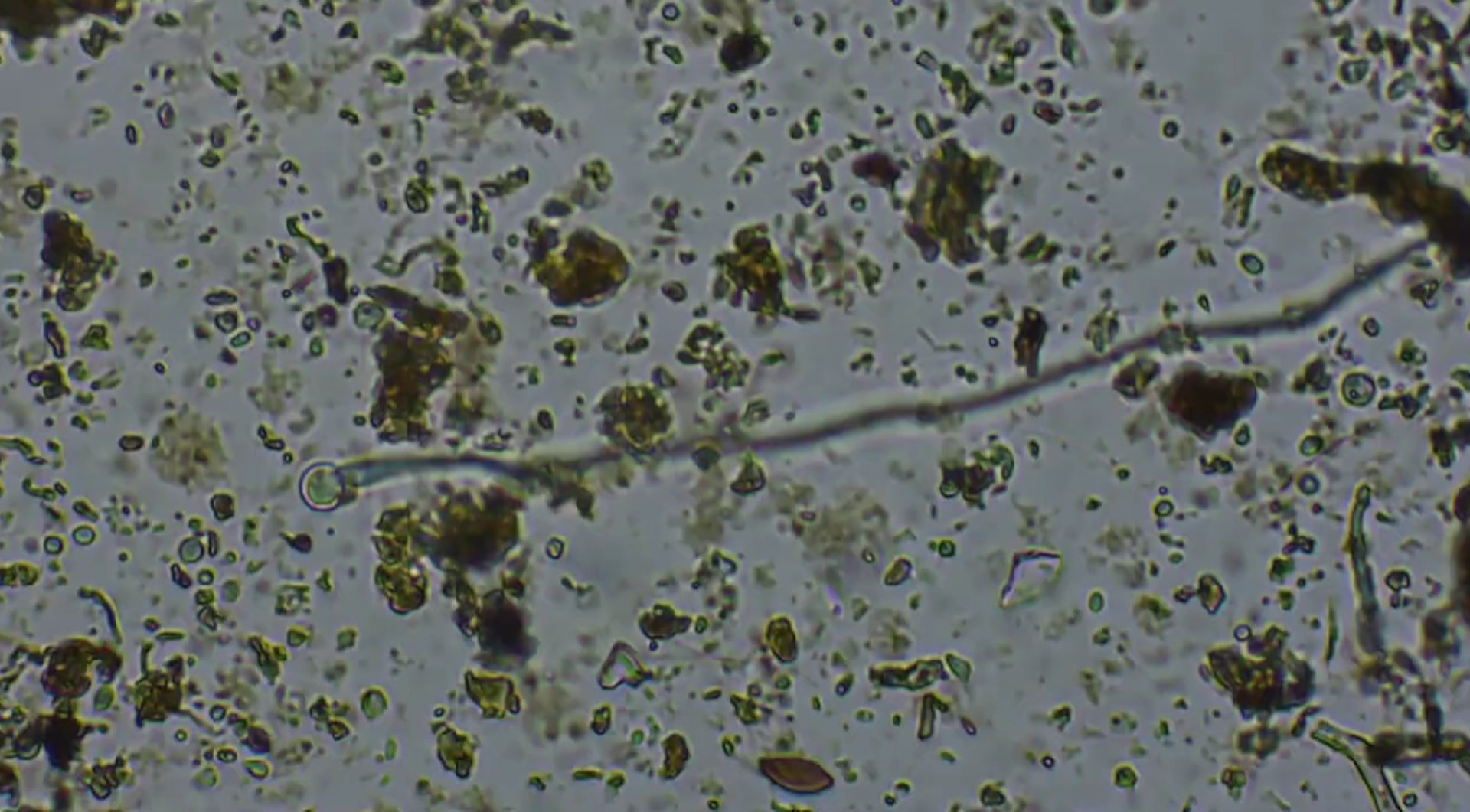 microscope image of soil and soil microbes
