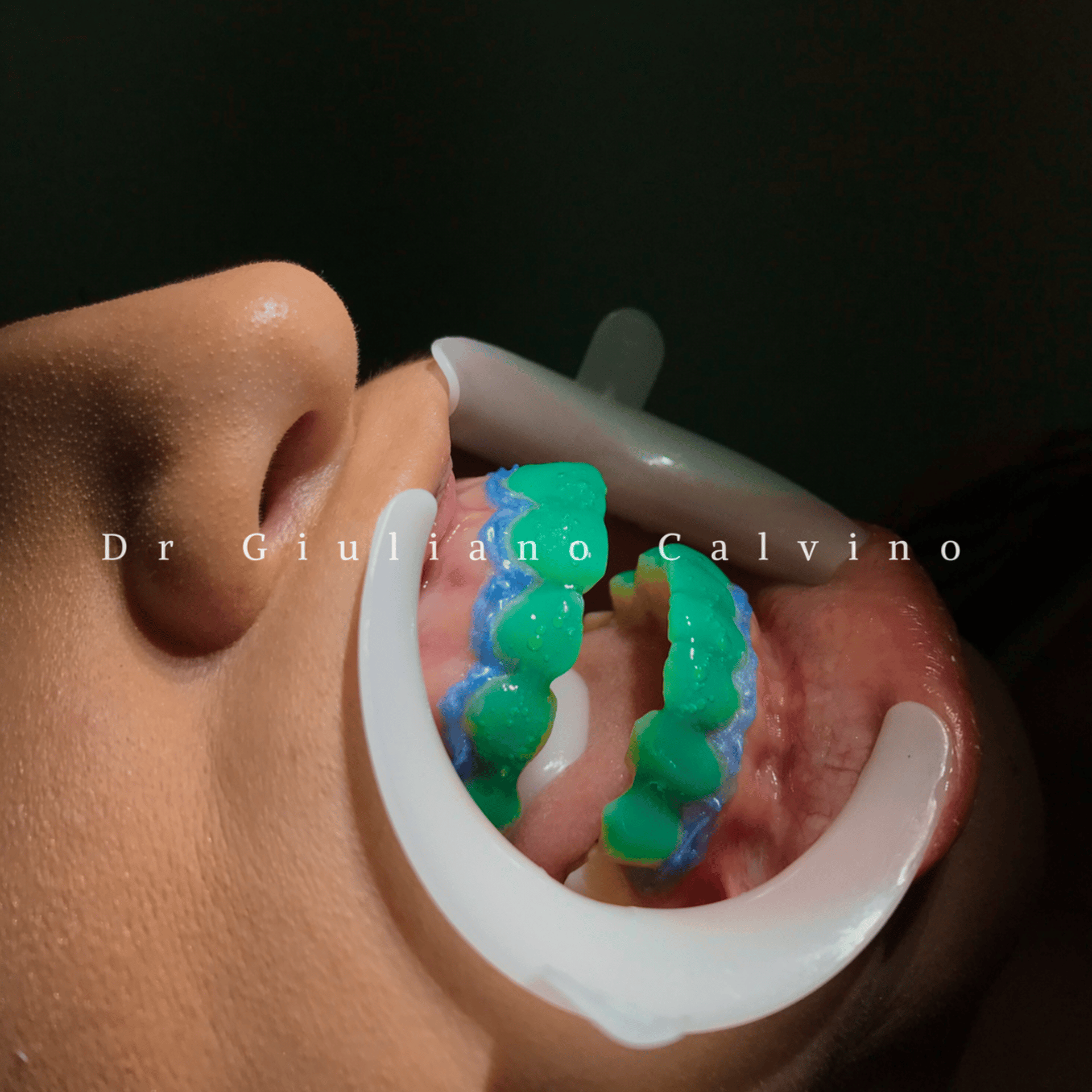 a black and white photo of a chess board