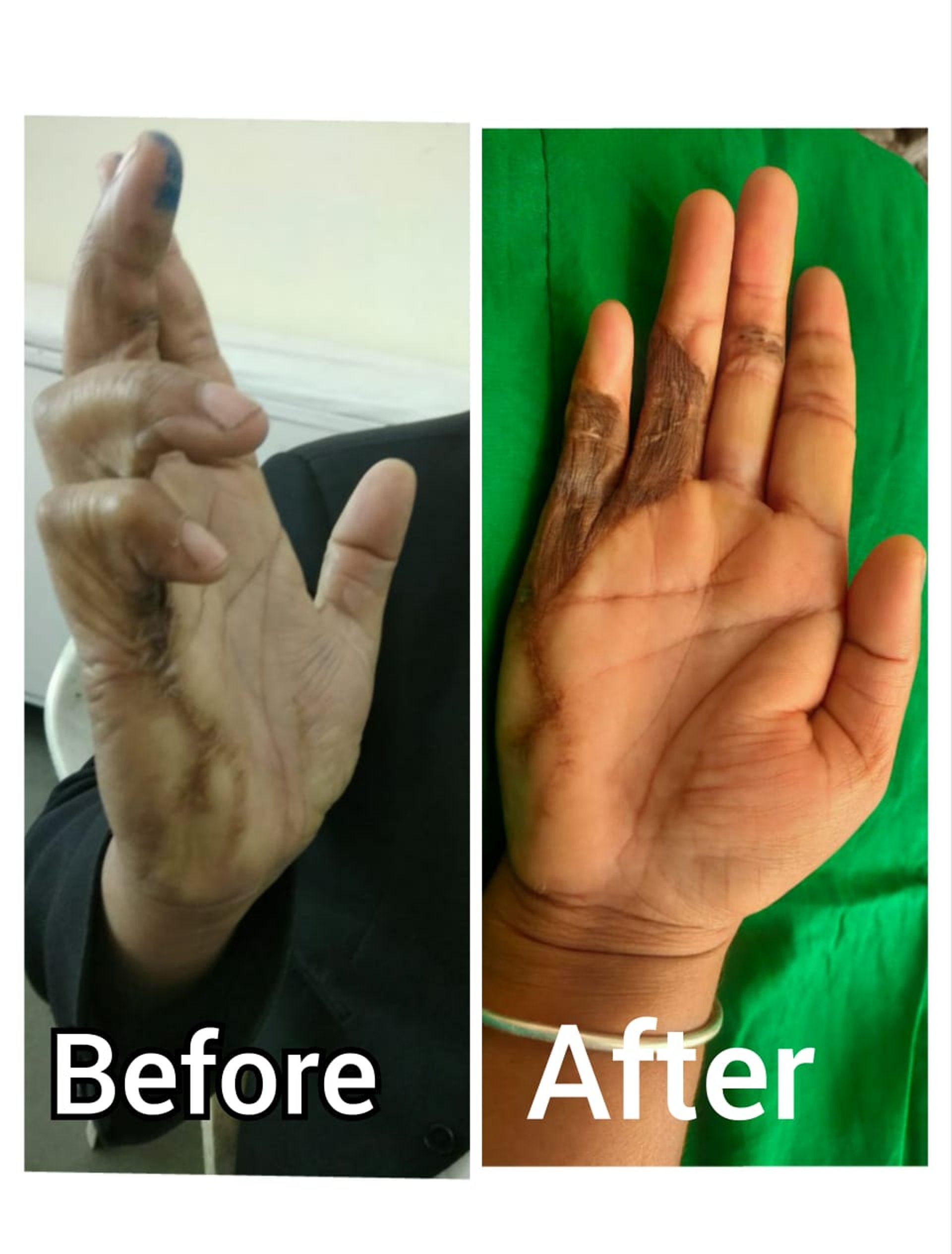 black blue and yellow textile