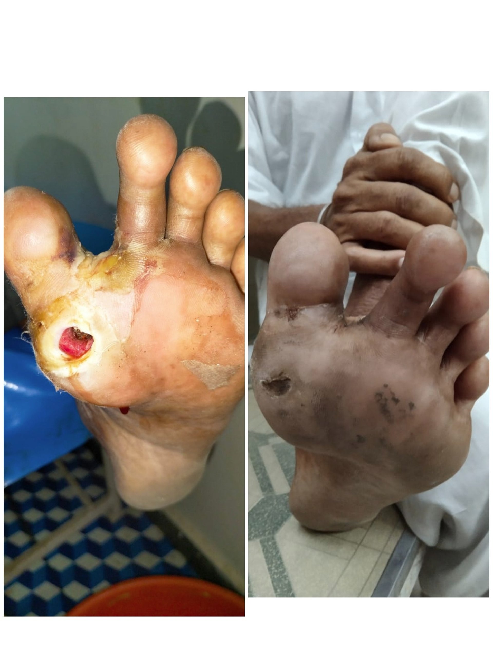 black blue and yellow textile