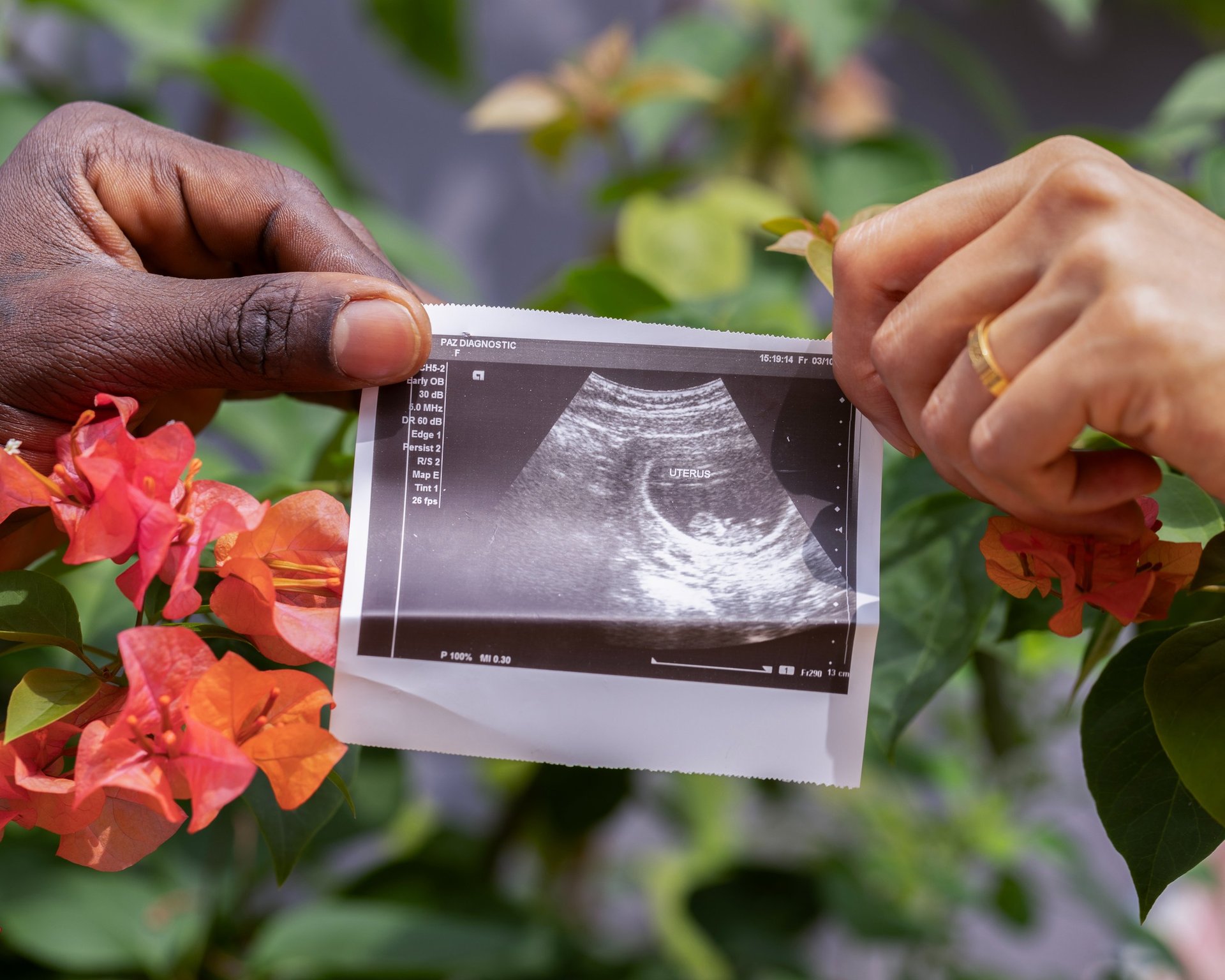 black and white bed linen