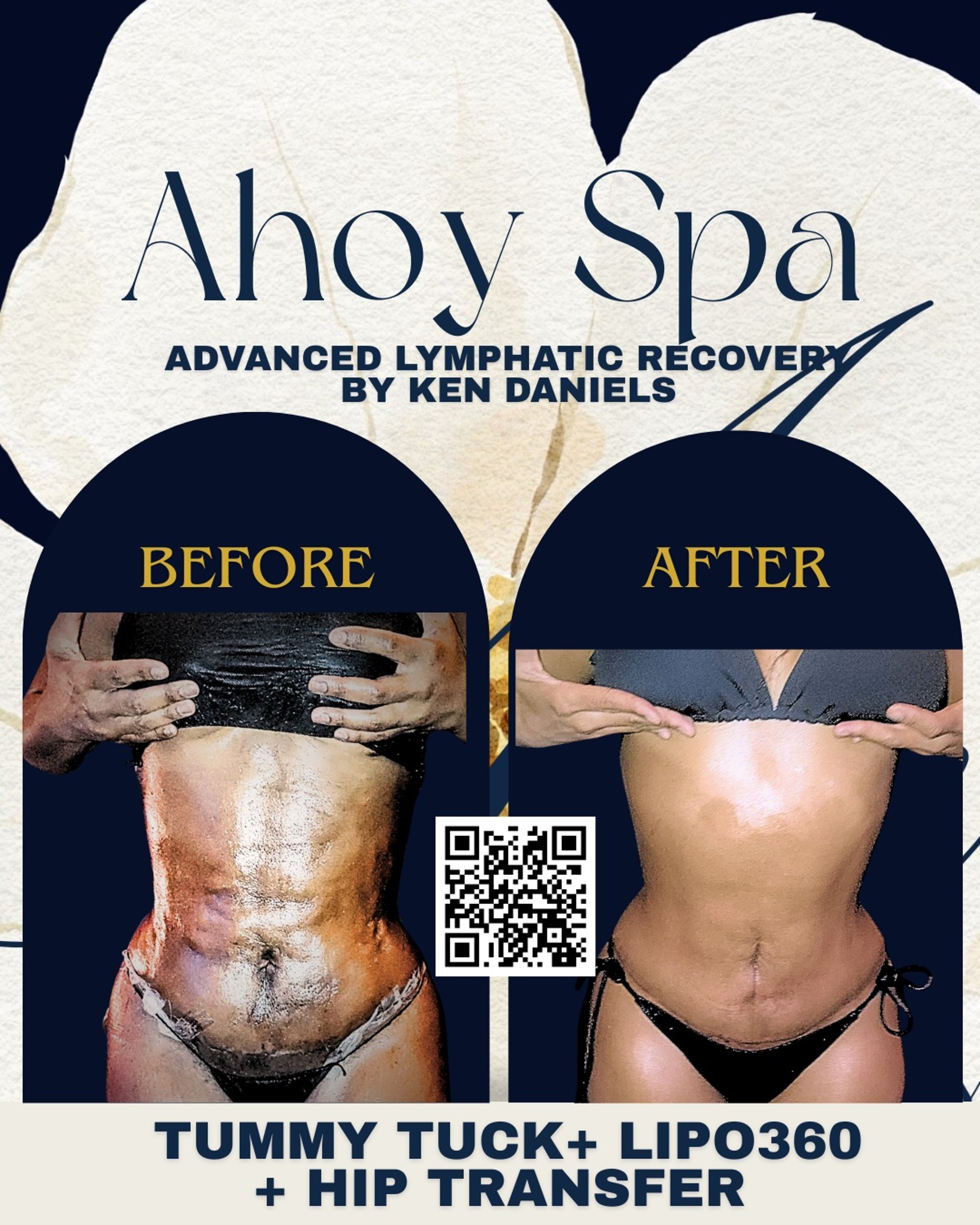 woman wearing yellow long-sleeved dress under white clouds and blue sky during daytime