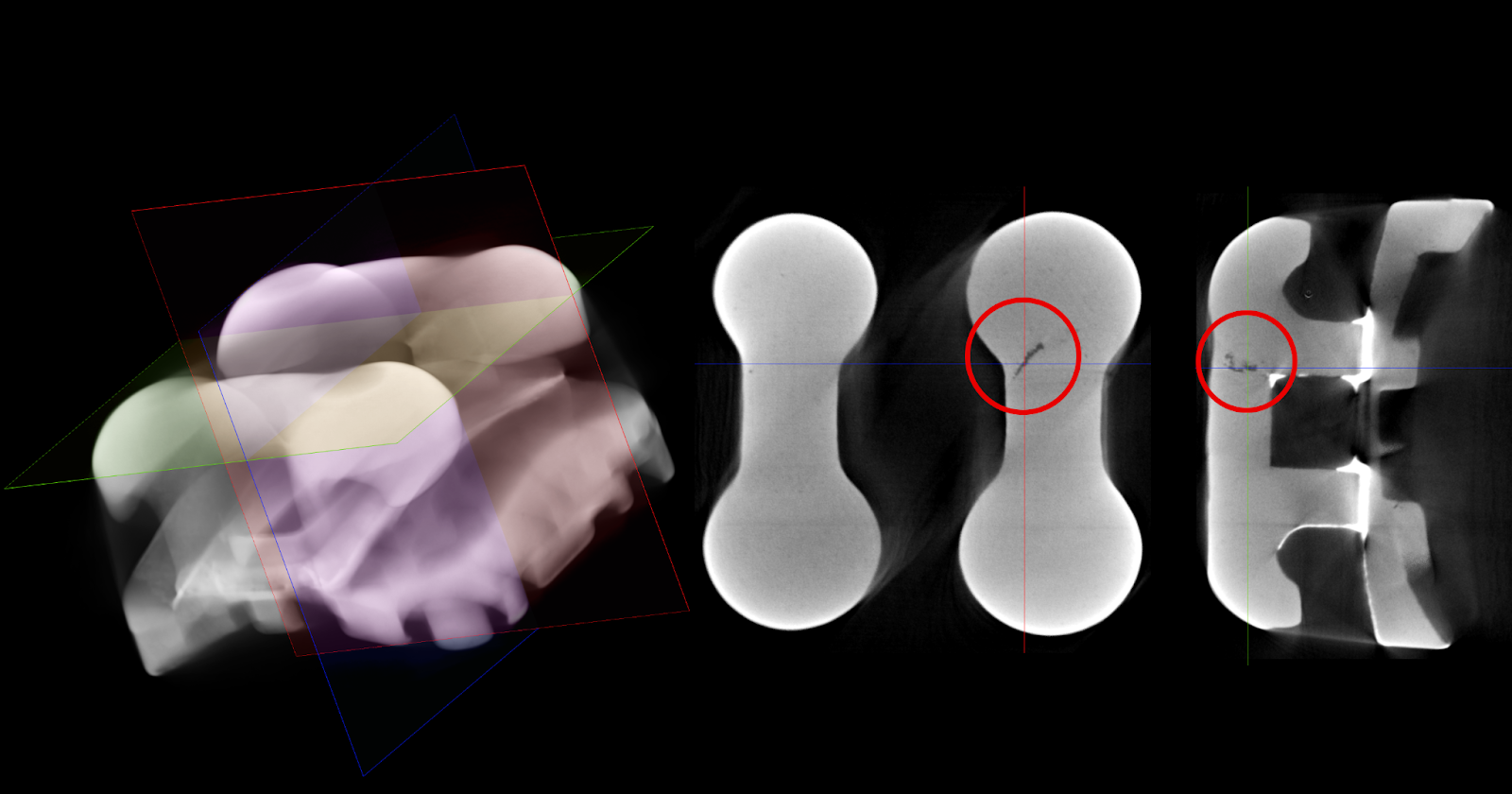 Lỗi thường gặp MIM