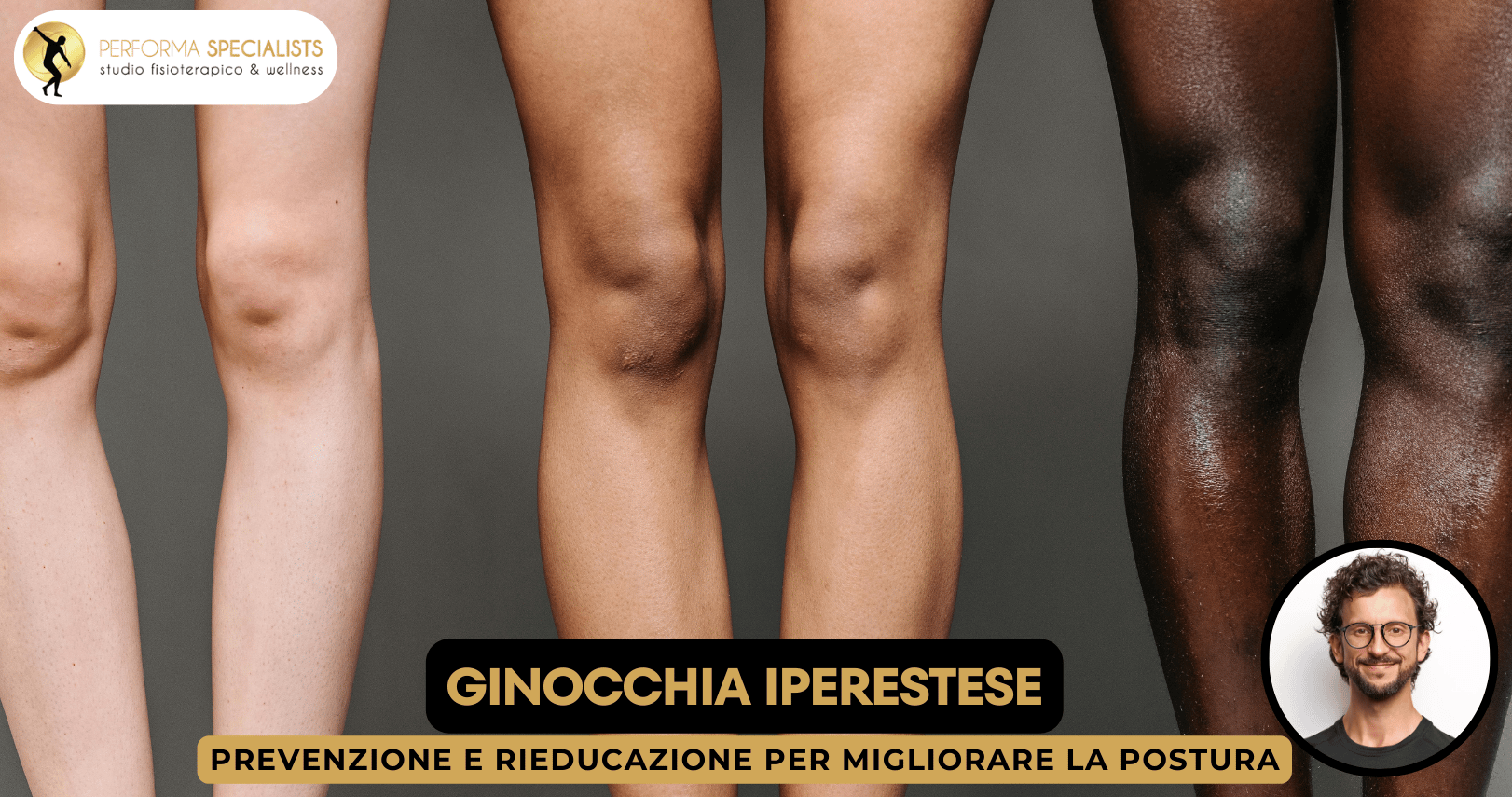 Analisi biomeccanica del ginocchio in iperestensione Performa Specialists By Dott. Alessandro Rossin