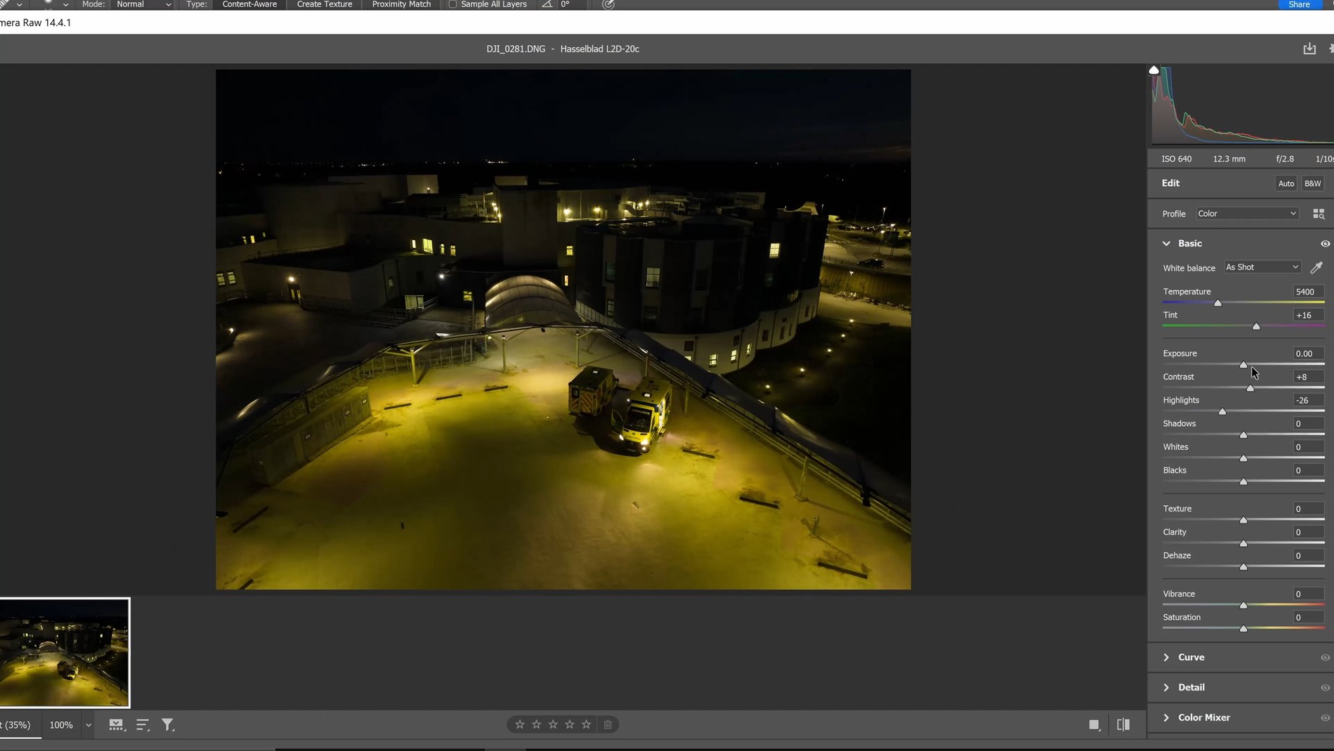 BBC Ambulance Editing 2