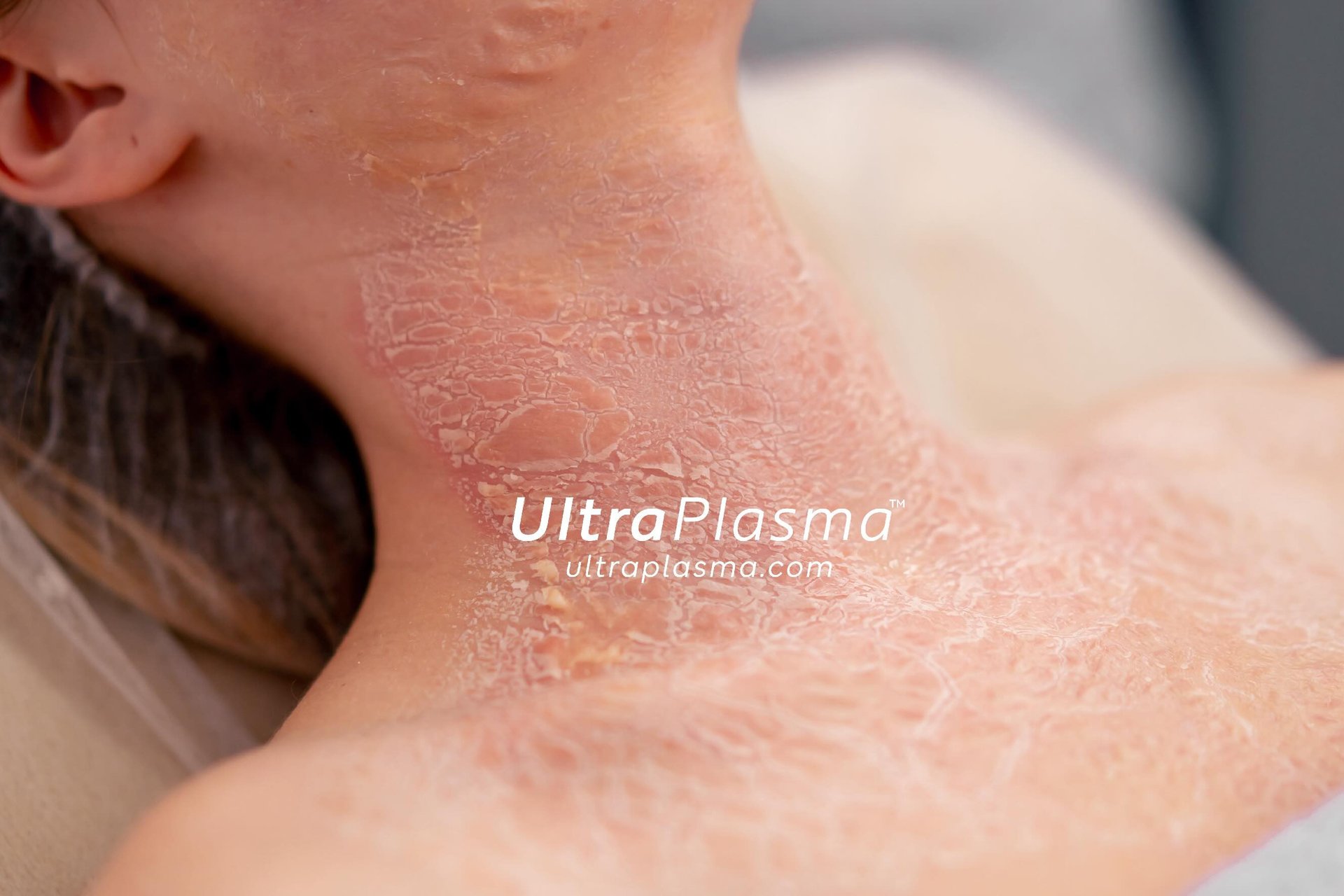 _ultra_plasma_ultra_plazma_ultra-plasma_ultra-plazma