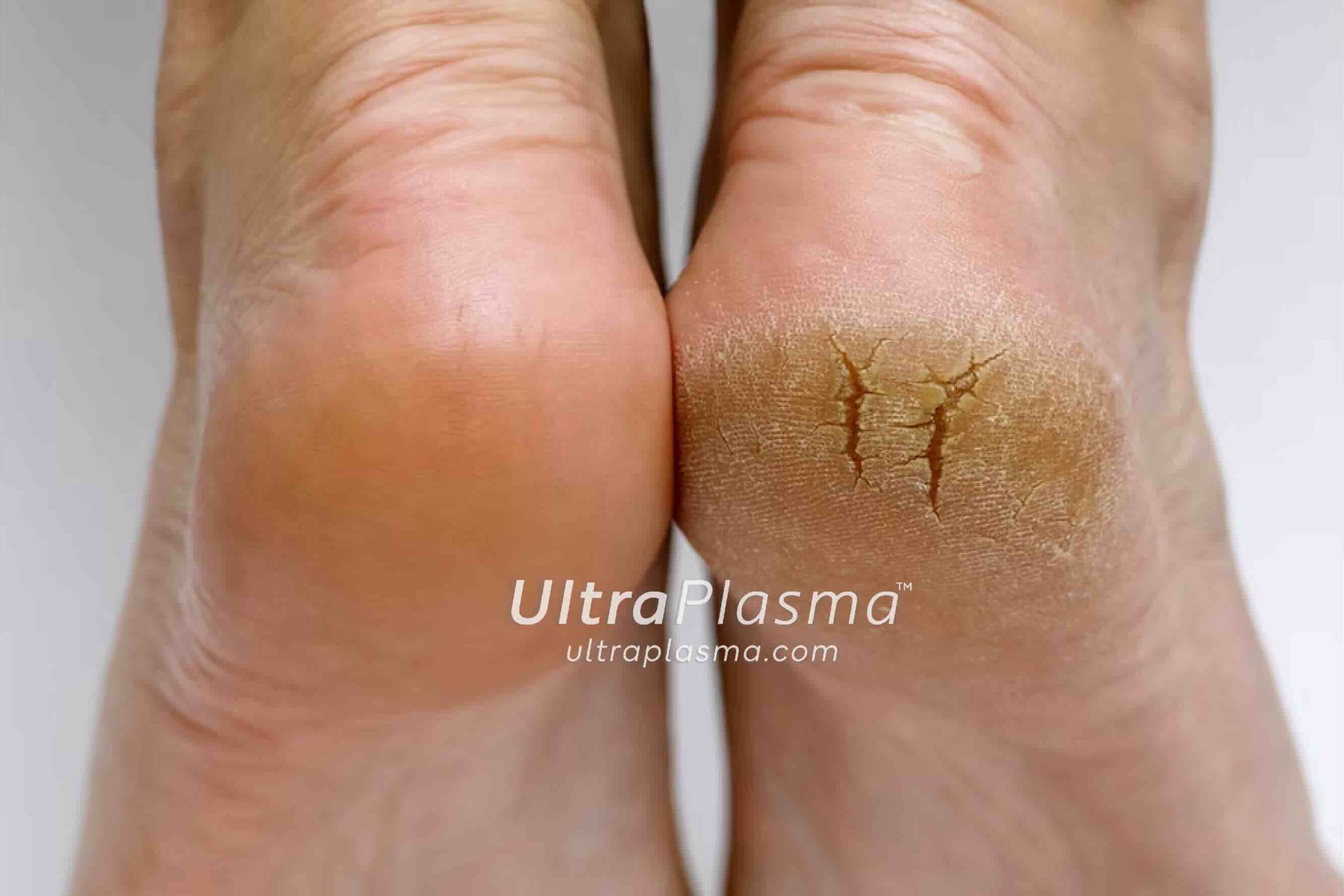 ultra_plasma_ultra_plazma_ultra-plasma_ultra-plazma