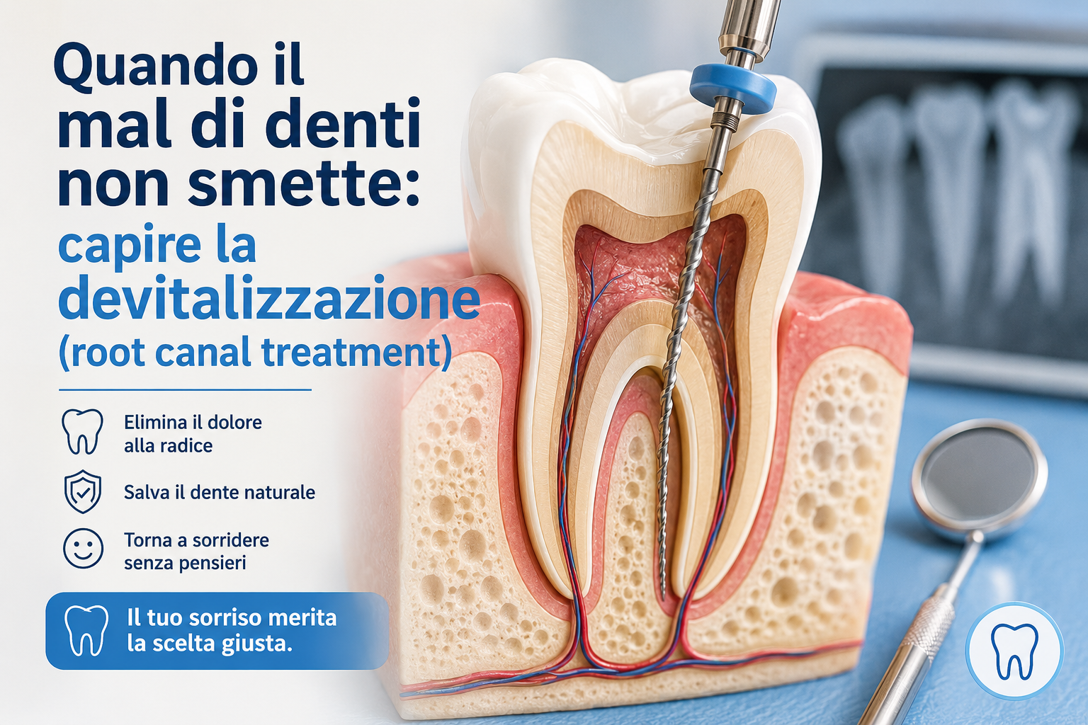 Anatomical cross-section model showing a root canal treatment procedure on a human tooth.