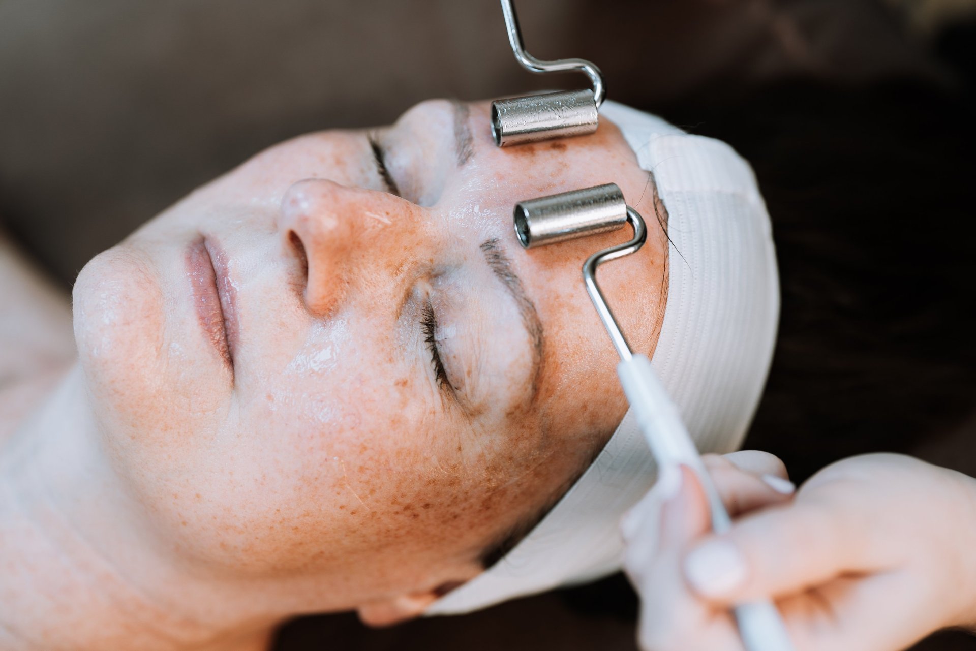 Professional acne facial treatment for breakout-prone skin in Ashford Kent.