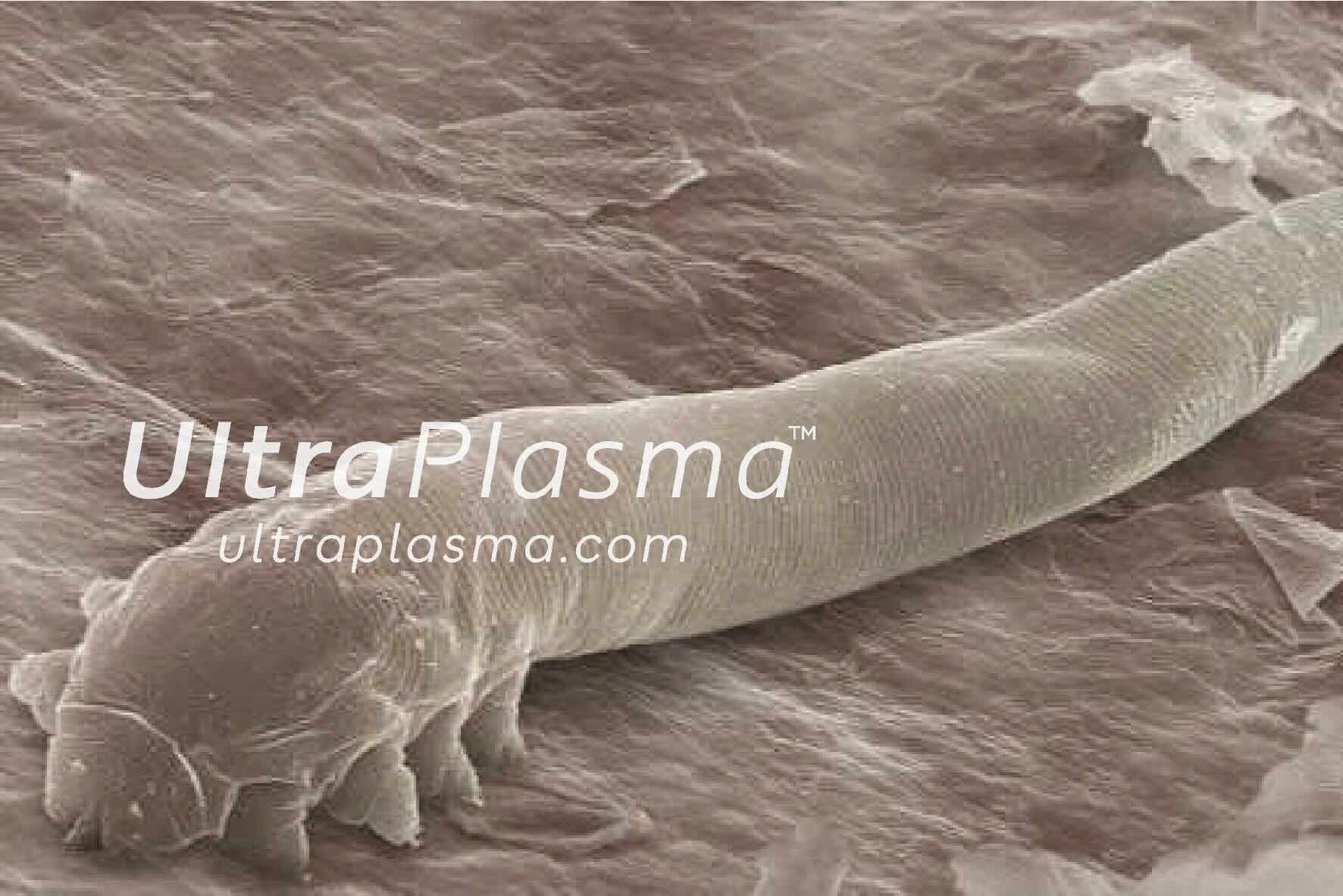 demodex_tedavi_treatment_ultra_plasma_ultra_plazma_ultra-plasma_ultra-plazma