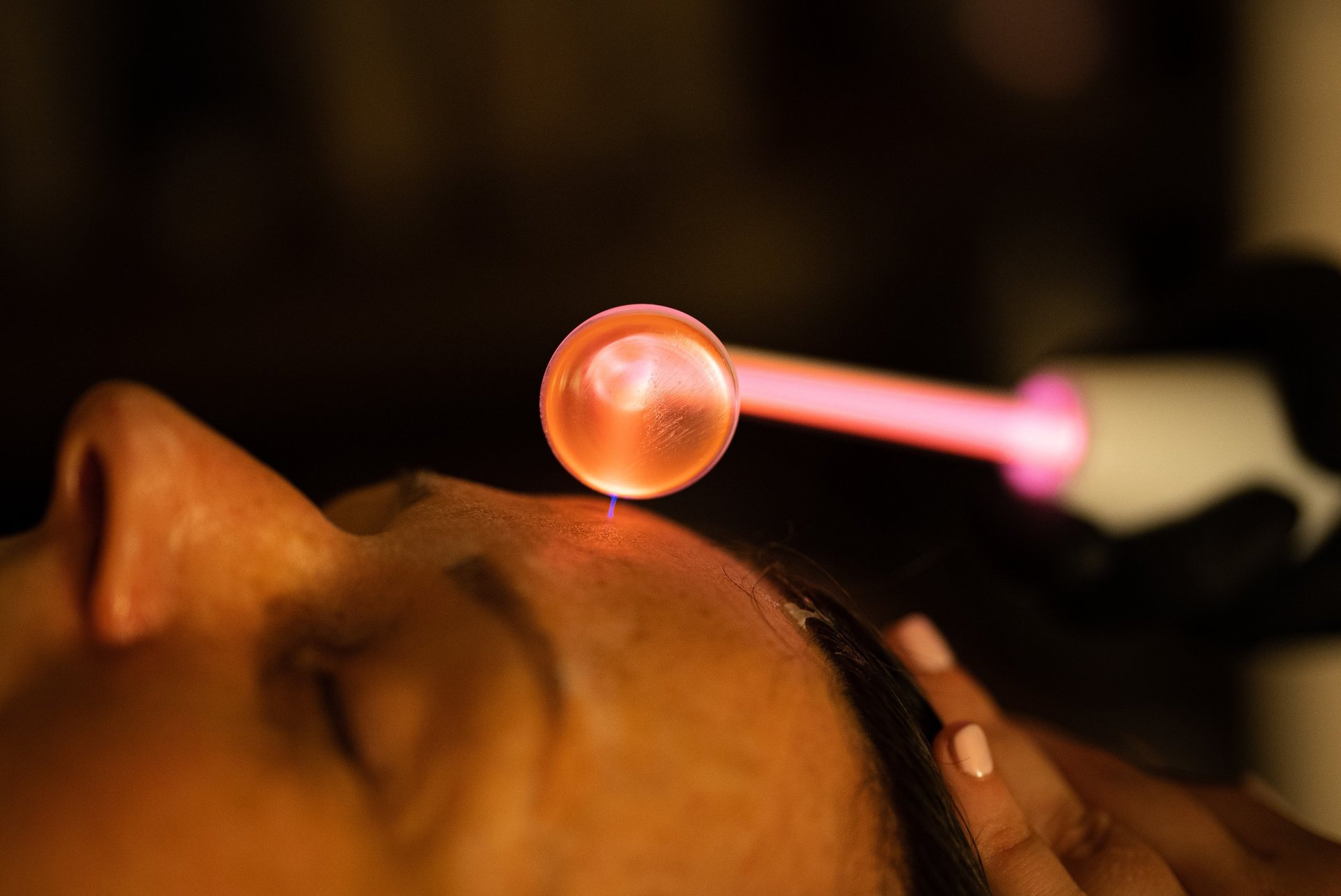 High frequency facial treatment to target acne breakouts in Ashford Kent.