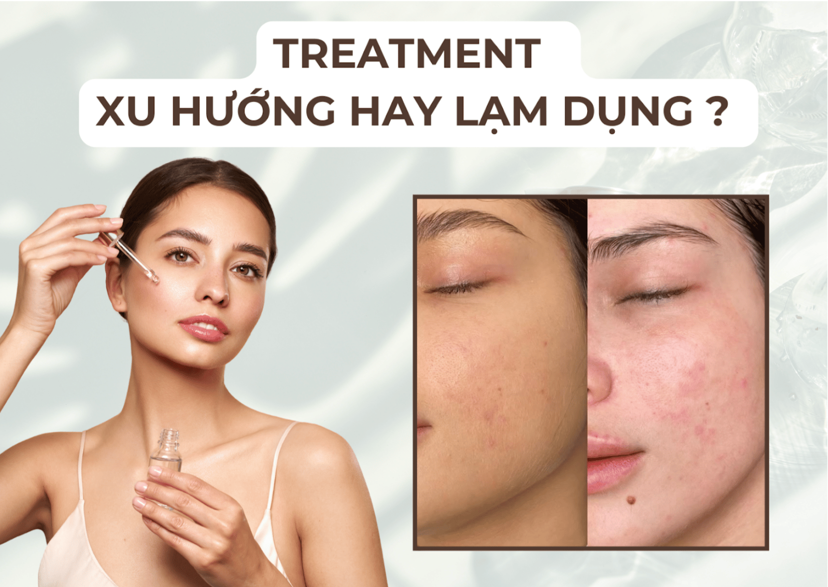 Treatment - Xu hướng hay lạm dụng