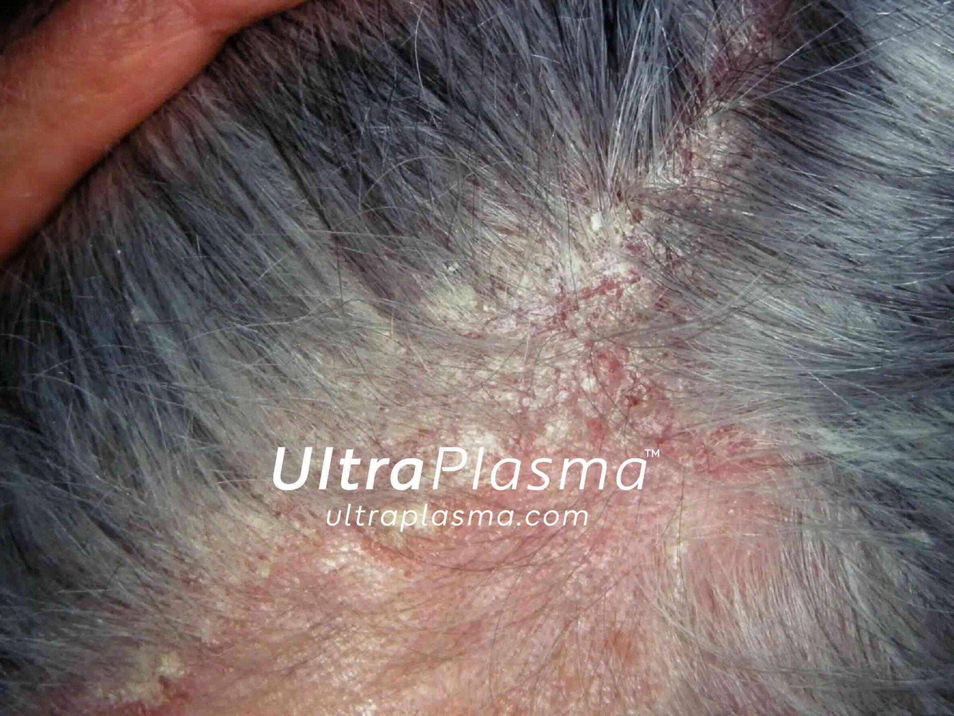 _ultra_plasma_ultra_plazma_ultra-plasma_ultra-plazma