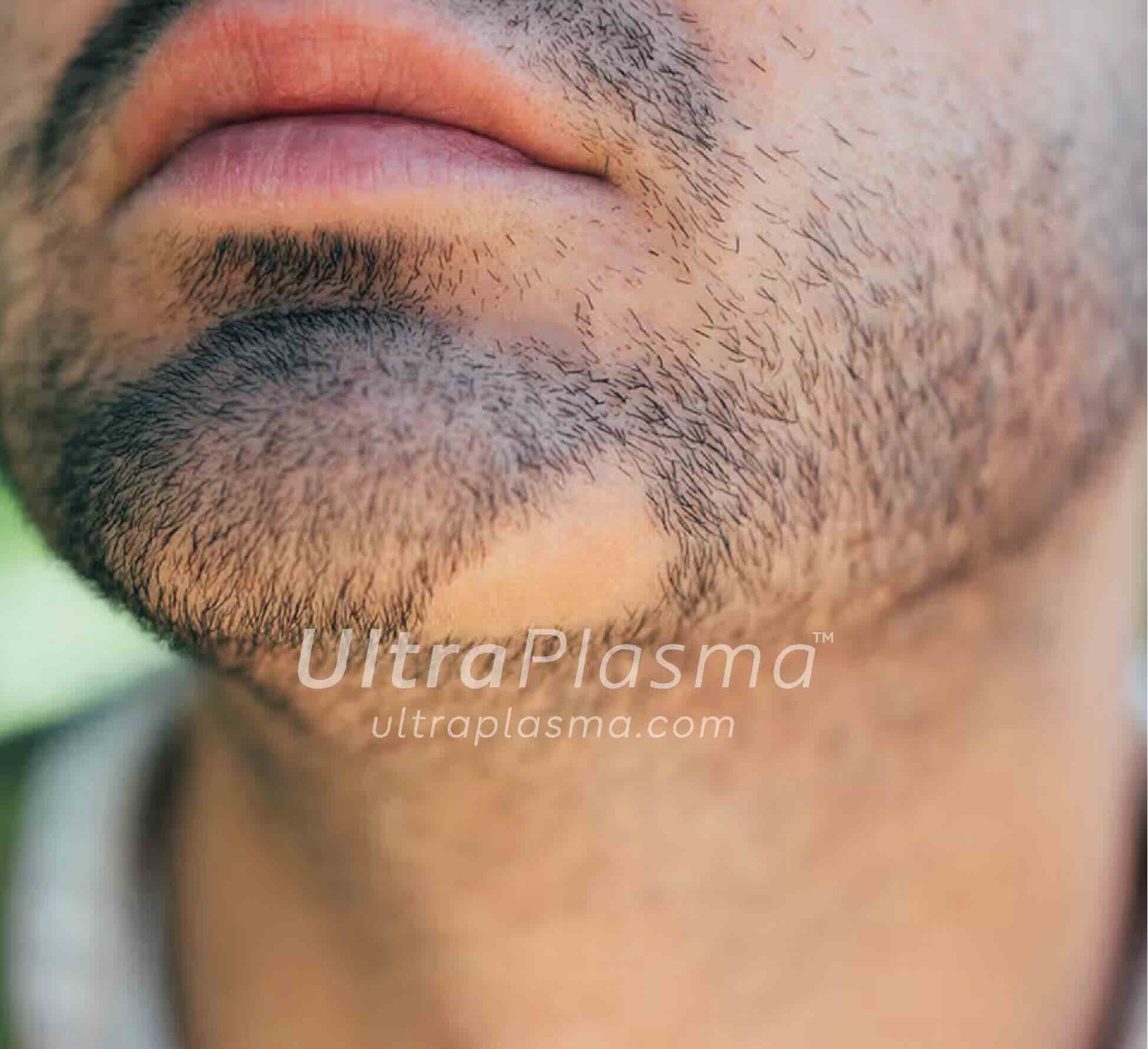 _ultra_plasma_ultra_plazma_ultra-plasma_ultra-plazma