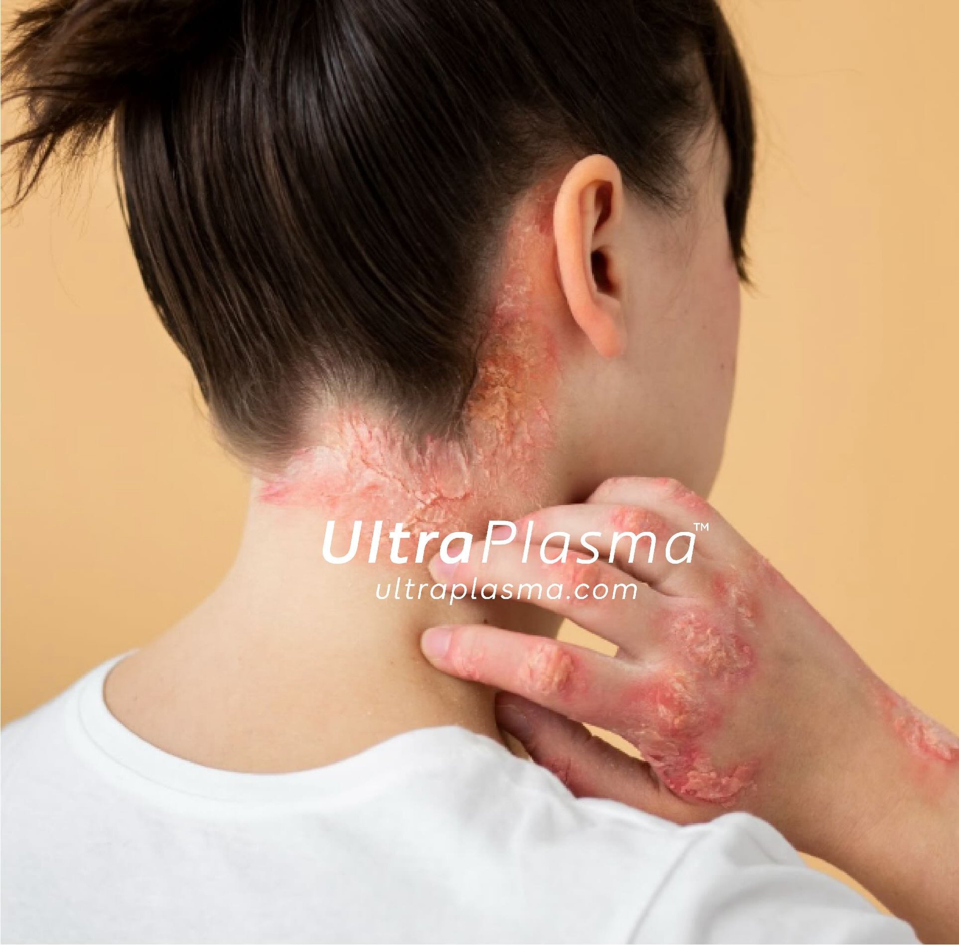 _ultra_plasma_ultra_plazma_ultra-plasma_ultra-plazma