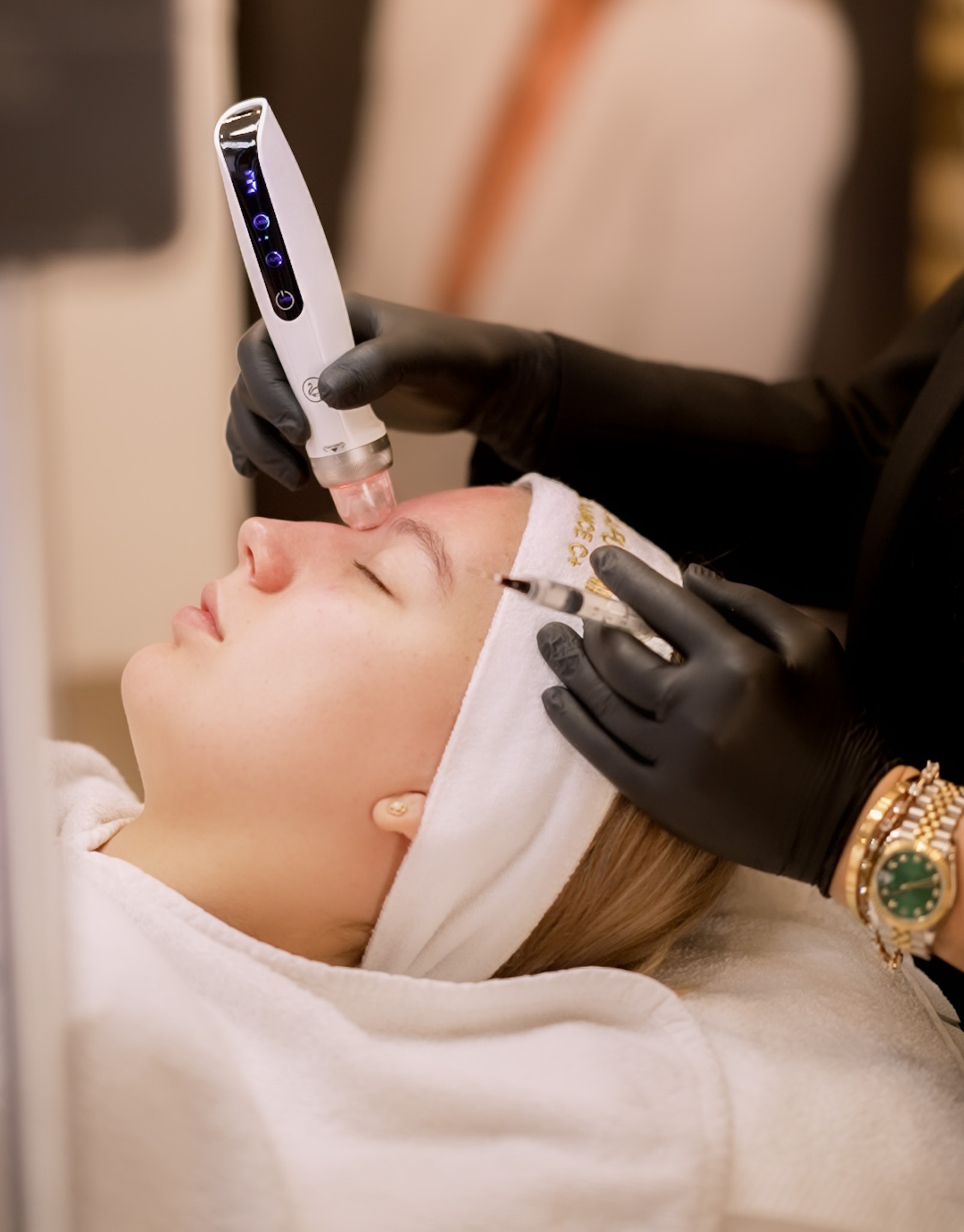soin de visage dermapen avec exosomes chez Medi Kiss Dermaclinic à Bruxelles