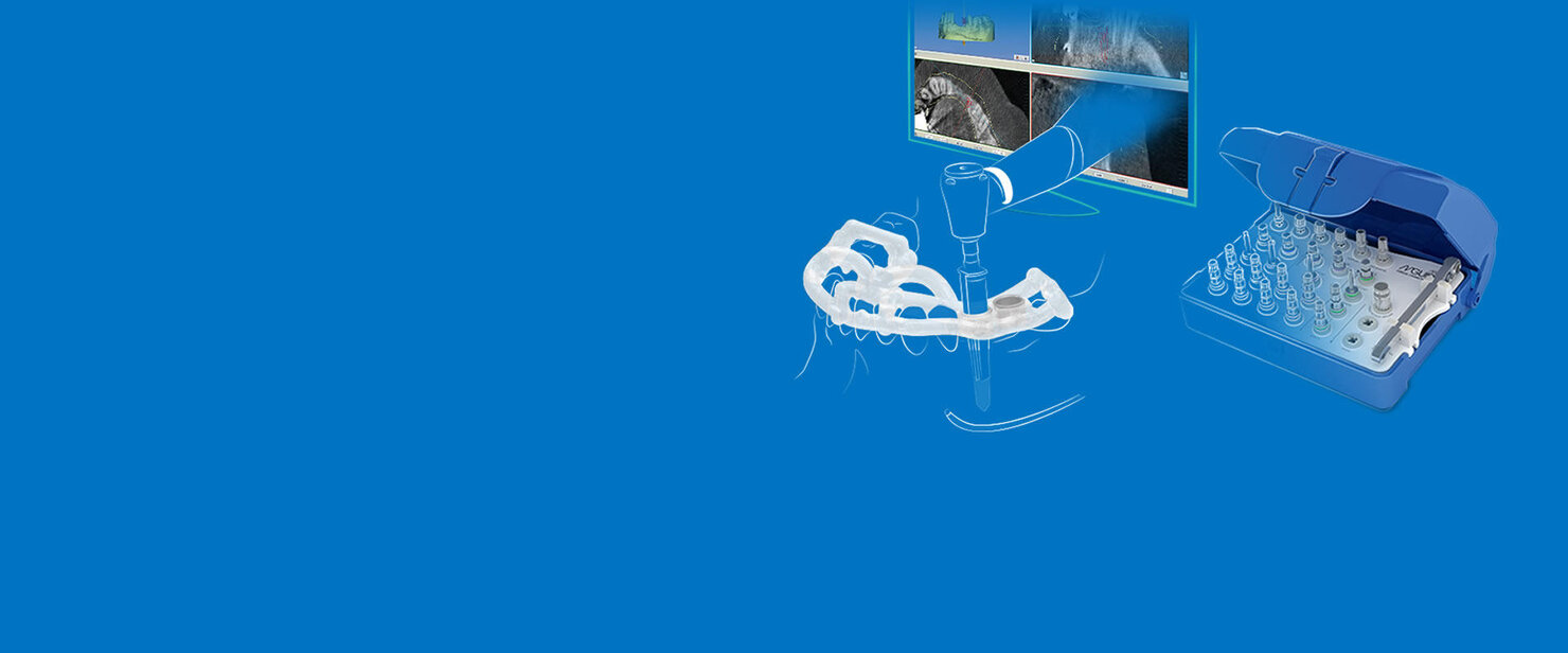 A dental surgical guide kit with digital software for guided implant surgery planning.