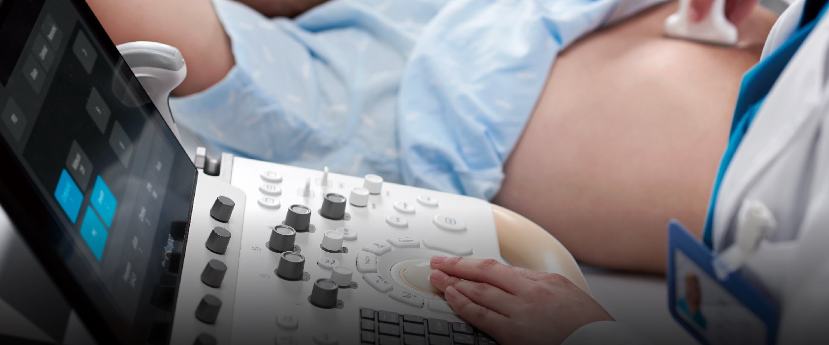 Aparelhos para Ultrassom e Ecocardiograma