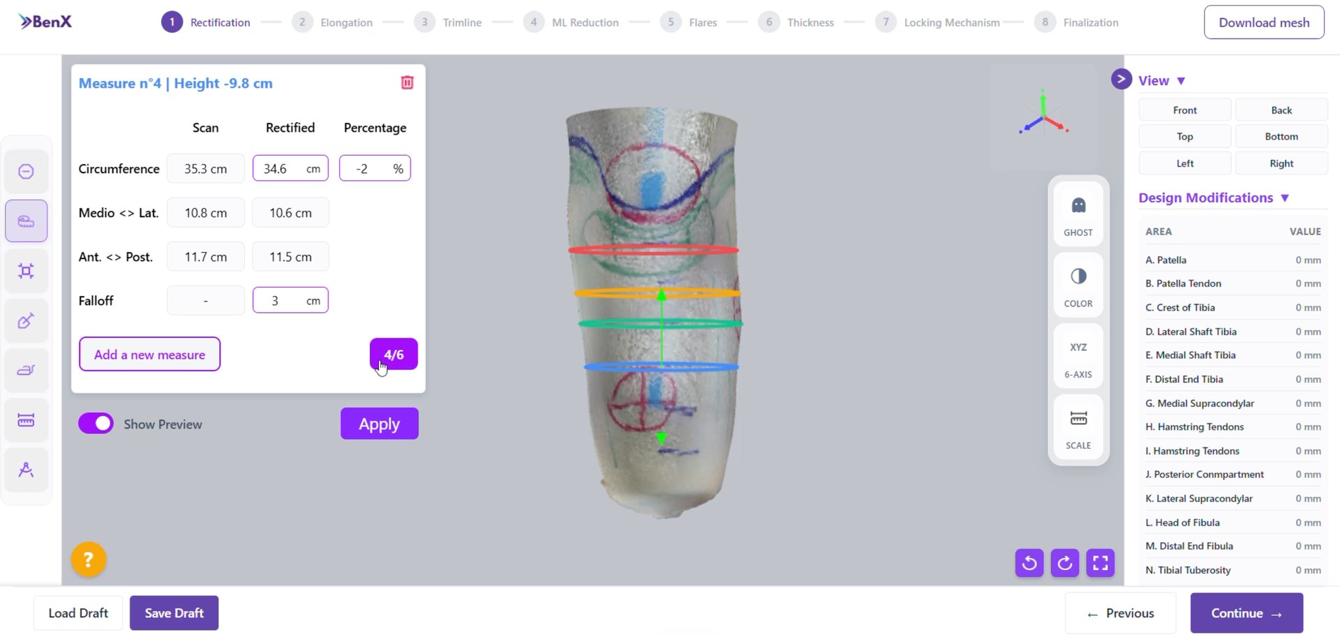 BenX clinician-led O&P workflow software