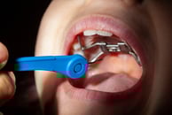 Functional & Orthopaedic Appliance