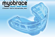 Myobraces or Trainers