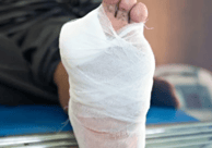 Diabetic Wound Care At home 