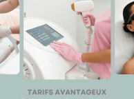 tarifs avantageux épilation laser