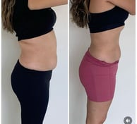 Foto mostrando redução de peso com prática de exercícios e nutrição balanceada.