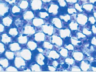 Structure plante vasculaire - cellules collenchymateuses