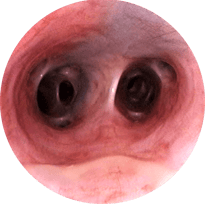 endoscopia veterinaria respiratorio traquea rinoscopia