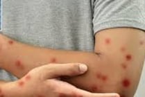 A warning sign of diabetes (5)