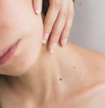 Skin Needling Benefits You Can’t Ignore!