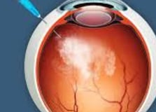 retinitis pigmentosa treatmen