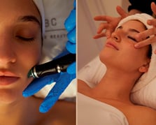Beneficios hydrafacial