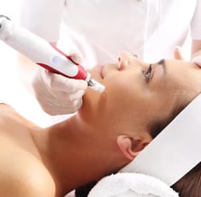 Skin Needling Benefits You Can’t Ignore!