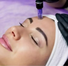 Skin Needling Benefits You Can’t Ignore!