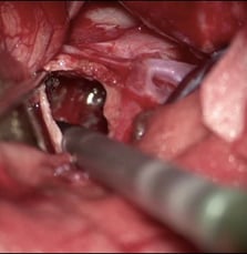 Operative Pictures