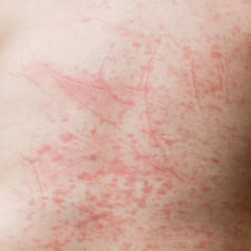a man with a red spot on his chest and chest