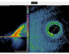 Left: NOAA P-3 tail radar Dorian 1Sept2019, Right KAMX radar from land near Miami, FL. Photo Twitter by @wx_trev 9Sept2019