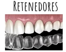 retenedores dentales