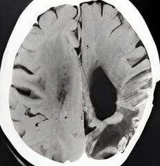 MRI OF 2021