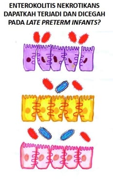 diagram enterokolitis nekrotikans