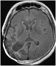 MRI OF 2021