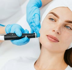 Skin Needling Benefits You Can’t Ignore!