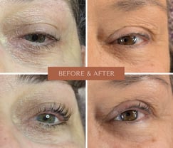 before and after images of a lash lift and tint