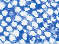 Structure plante vasculaire - cellules collenchymateuses