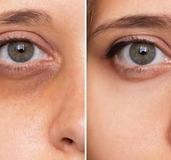 Botox-preenchimento-labial-bio-estimulador-de-colageno-em-pitanga-região-dra.-josiane