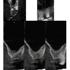 CBCT Scan Report